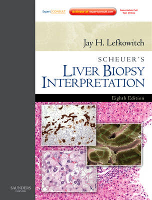 Scheuer's Liver Biopsy Interpretation book