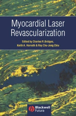 Myocardial Laser Revascularization book