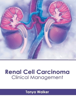 Renal Cell Carcinoma: Clinical Management book