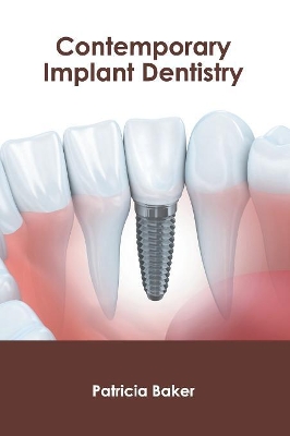 Contemporary Implant Dentistry book