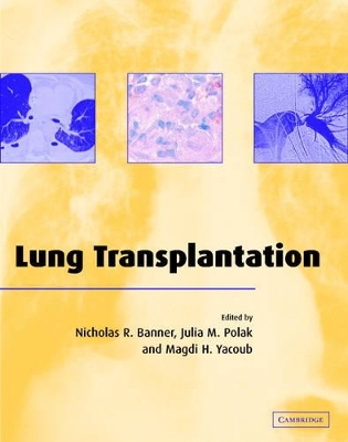 Lung Transplantation book
