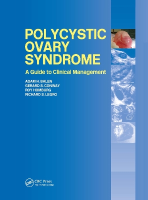 Polycystic Ovary Syndrome book