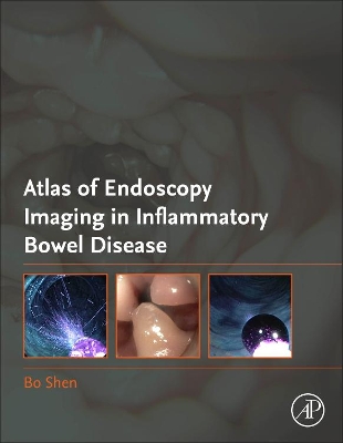 Atlas of Endoscopy Imaging in Inflammatory Bowel Disease book