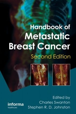 Handbook of Metastatic Breast Cancer, Second Edition by Stephen R D Johnston