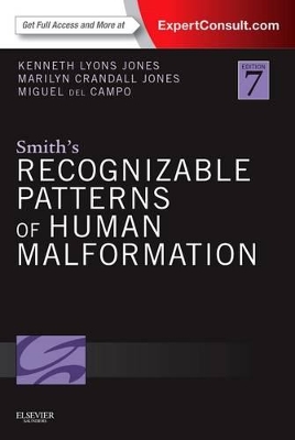 Smith's Recognizable Patterns of Human Malformation by Kenneth Lyons Jones