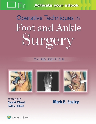 Operative Techniques in Foot and Ankle Surgery by Mark E. Easley