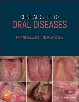 Clinical Guide to Oral Diseases by Dimitris Malamos
