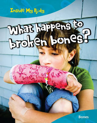 What Happens to Broken Bones? book