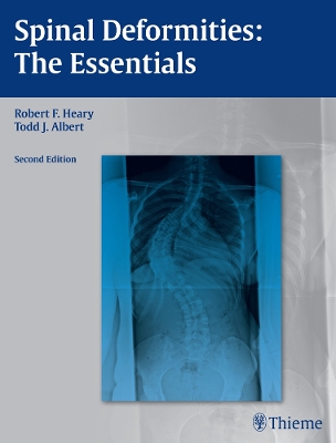 Spinal Deformities book