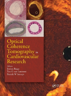 Optical Coherence Tomography in Cardiovascular Research book