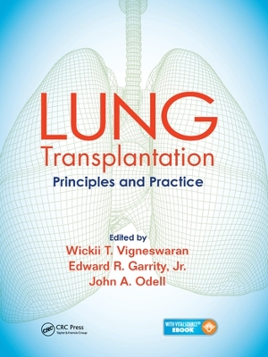 Lung Transplantation: Principles and Practice by Wickii Vigneswaran