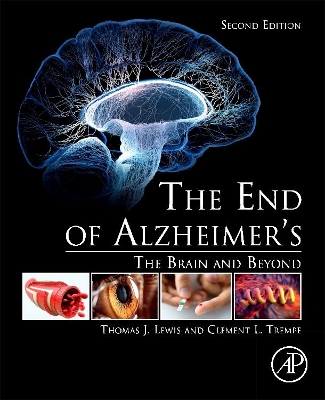 End of Alzheimer's book