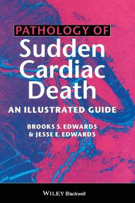 Pathology of Sudden Cardiac Death book