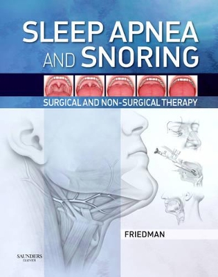 Sleep Apnea and Snoring by Michael Friedman