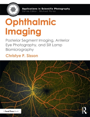 Ophthalmic Imaging: Posterior Segment Imaging, Anterior Eye Photography, and Slit Lamp Biomicrography book