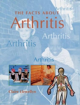 FACTS ABOUT ARTHRITIS book
