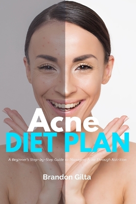 Acne Diet Plan: A Beginner's Step-by-Step Guide to Managing Acne Through Nutrition With Curated Recipes and a Sample Meal Plan book