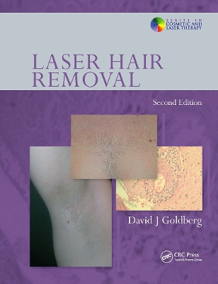 Laser Hair Removal book