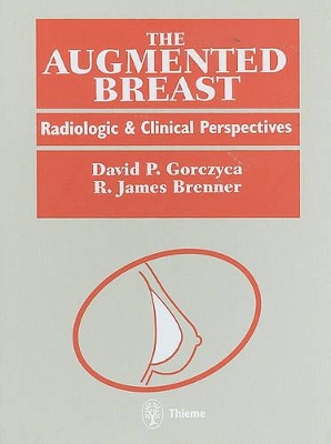 The Augmented Breast: Radiologic and Clinical Perspectives book