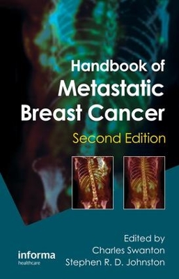 Handbook of Metastatic Breast Cancer by Charles Swanton
