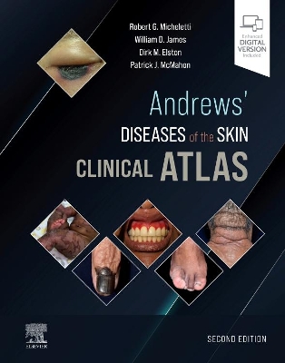 Andrews' Diseases of the Skin Clinical Atlas book