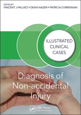 Diagnosis of Non-accidental Injury book