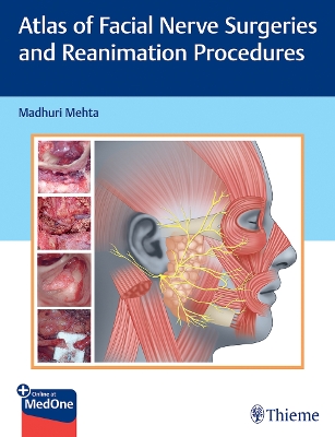 Atlas of Facial Nerve Surgeries and Reanimation Procedures book