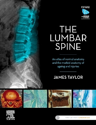 The Lumbar Spine: An Atlas of Normal Anatomy and the Morbid Anatomy of Ageing and Injury book