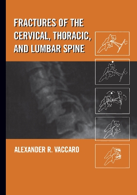Fractures of the Cervical, Thoracic and Lumbar Spine by Alexander R. Vaccaro