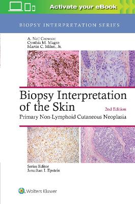 Biopsy Interpretation of the Skin by A. Neil Crowson