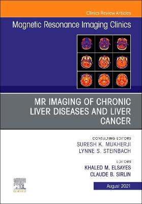 MR Imaging of Chronic Liver Diseases and Liver Cancer, An Issue of Magnetic Resonance Imaging Clinics of North America: Volume 29-3 book