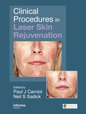 Clinical Procedures in Laser Skin Rejuvenation book