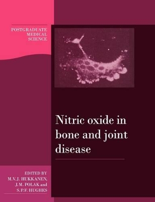 Nitric Oxide in Bone and Joint Disease by Mika V. J. Hukkanen