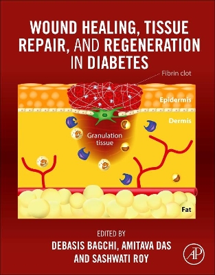 Wound Healing, Tissue Repair, and Regeneration in Diabetes book