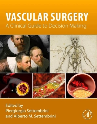 Vascular Surgery: A Clinical Guide to Decision-making book