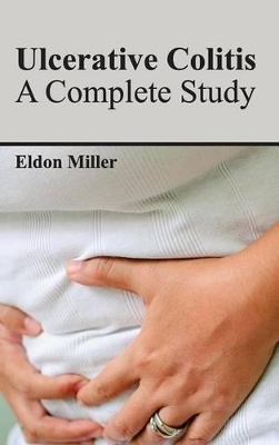 Ulcerative Colitis book