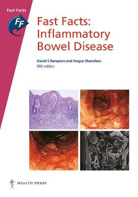 Fast Facts: Inflammatory Bowel Disease by David S Rampton