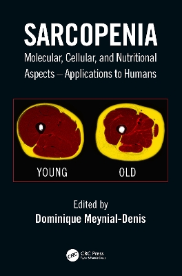 Sarcopenia: Molecular, Cellular, and Nutritional Aspects – Applications to Humans book