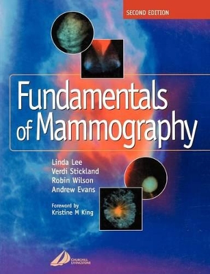 Fundamentals of Mammography by Sue Williams