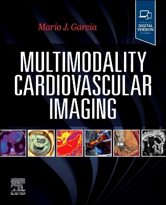 Multimodality Cardiovascular Imaging book