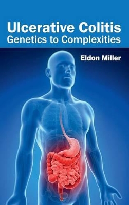 Ulcerative Colitis by Eldon Miller
