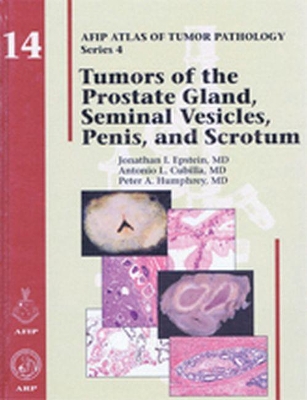 Tumors of the Prostate Gland, Seminal Vesicles, Penis, and Scrotum book
