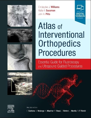 Atlas of Interventional Orthopedics Procedures: Essential Guide for Fluoroscopy and Ultrasound Guided Procedures book