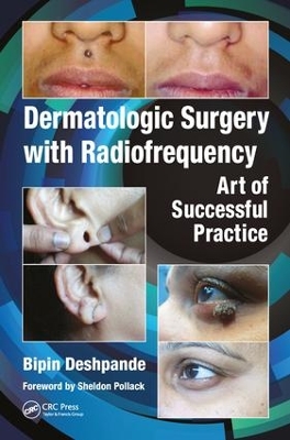 Dermatologic Surgery with Radiofrequency book