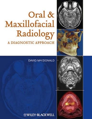 Oral and Maxillofacial Radiology by David MacDonald