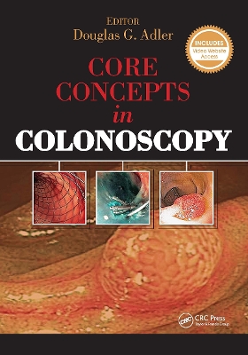 Core Concepts in Colonoscopy book