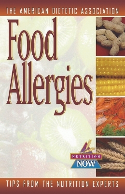 Food Allergies book