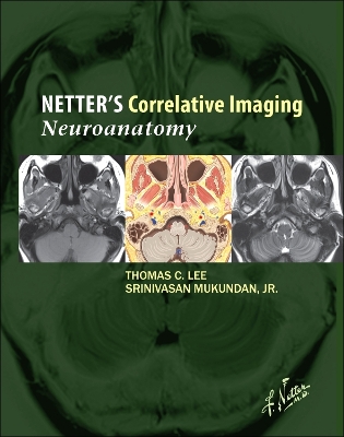 Netter's Correlative Imaging: Neuroanatomy book