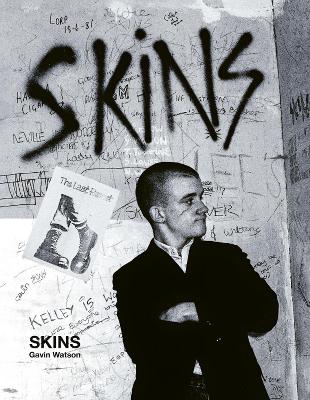 Skins: Gavin Watson by Gavin Watson