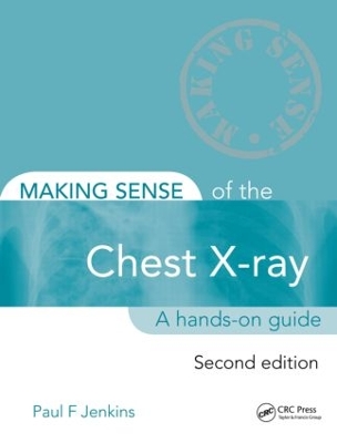 Making Sense of the Chest X-ray, Second Edition book